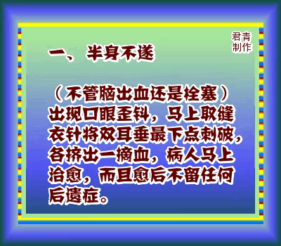 中医文化博大精深，其中包含了众多实用的急救方法。今天，我们就来介绍四种中医救命法