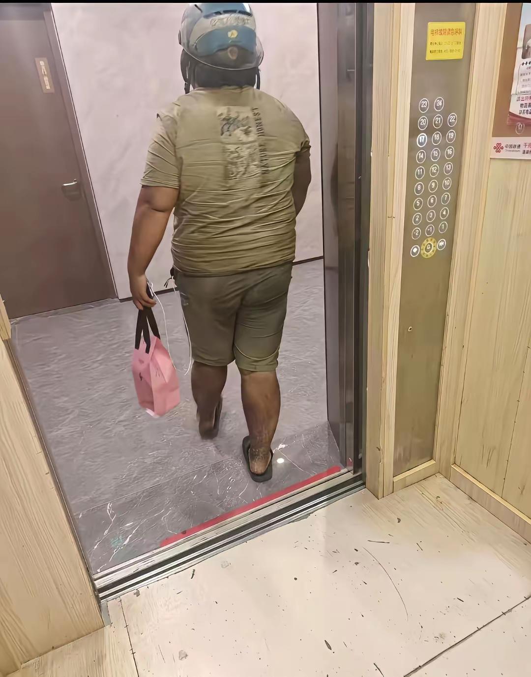 今天电梯里见一个外卖小哥，他腿上这种是怎么回事？
这是被烧伤的吗？看着感觉有点瘆