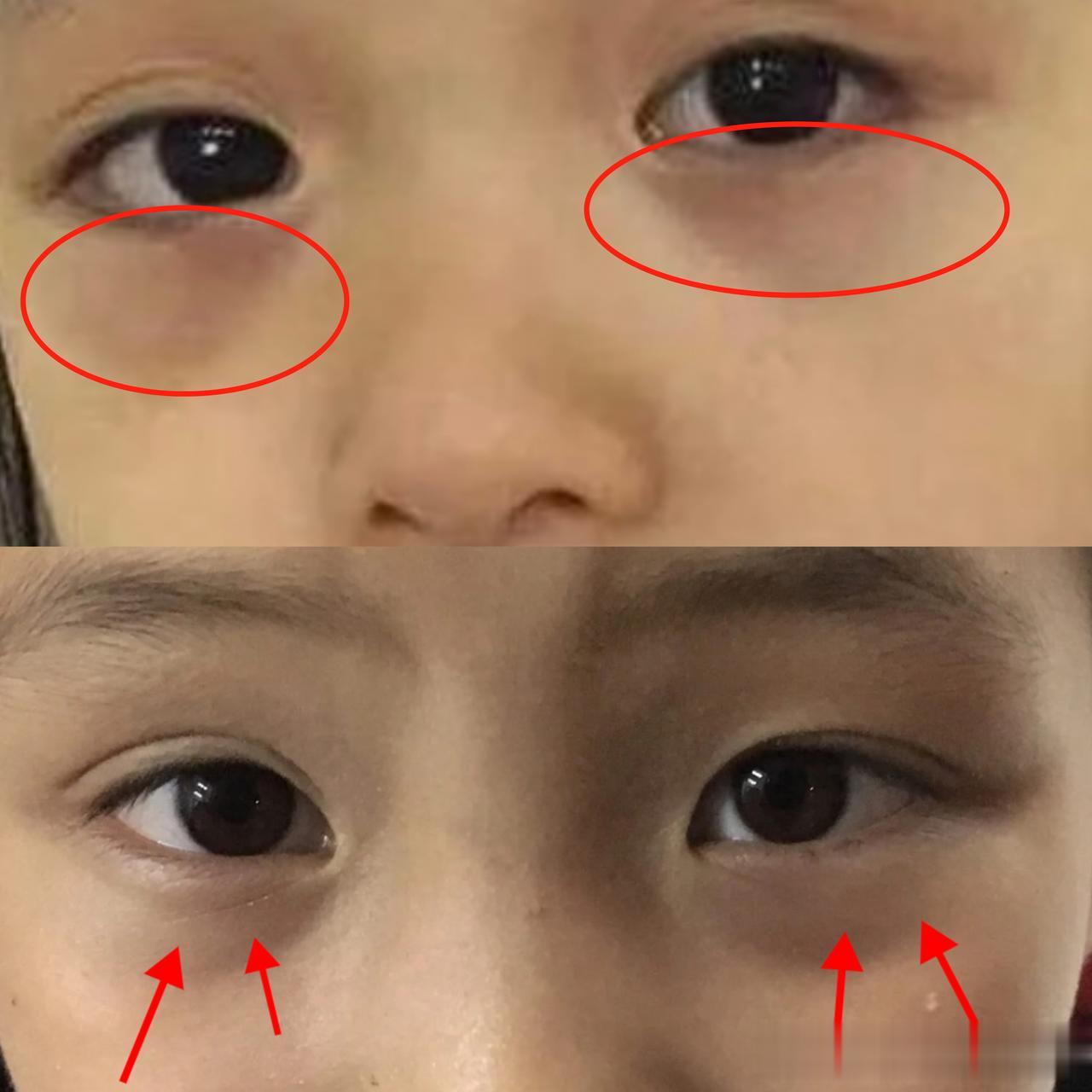 为什么我每次都要看孩子的“面容照”？主要看4点，学会了你也能一眼辨别
 
1、看