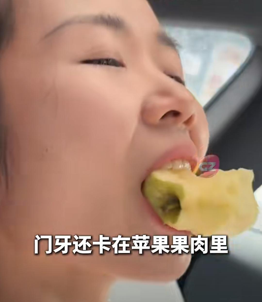 一口苹果致下巴脱臼，女子叼着苹果紧急就医
 
近日，浙江杭州姜女士的经历引发网友