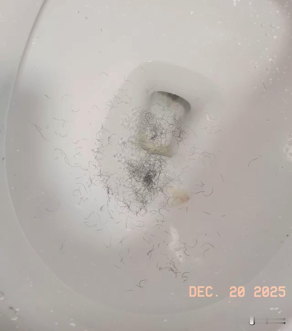 有没有推荐好一点的修毛器啊，
每隔一段时间就要来一次，
太烦人了，真的想一次性搞