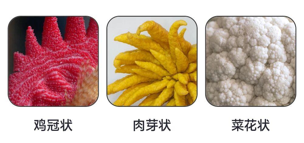 容易感染HPV的人，都有一个不太健康的习惯，医生：难怪HPV不转阴！

我妇科病