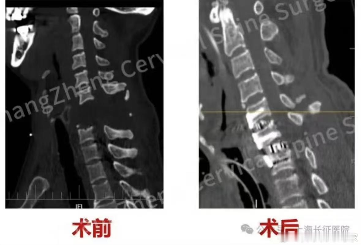 “身首离断”光是听起来就头皮发麻，居然还能给连接起来，真是把这个人从鬼门关硬拉了