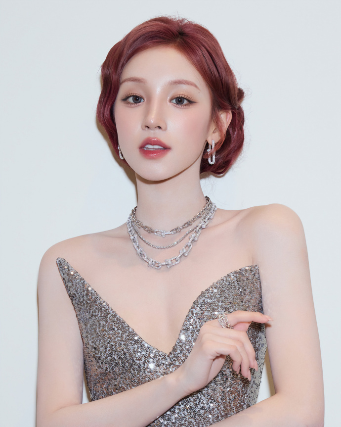 宋雨琦因伤暂时缺席录制跑男头部撞击+偏头痛复发，宋雨琦需暂停工作静养，父母紧急赴