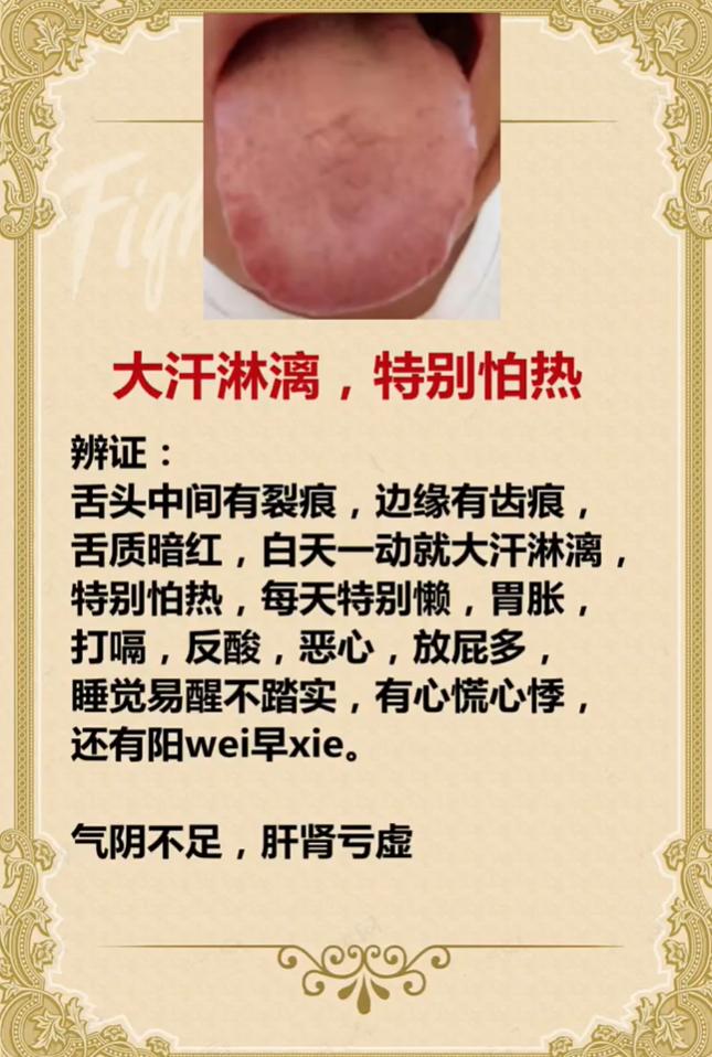 怕热多汗、浑身乏力？多半是气阴不足、肝肾亏虚