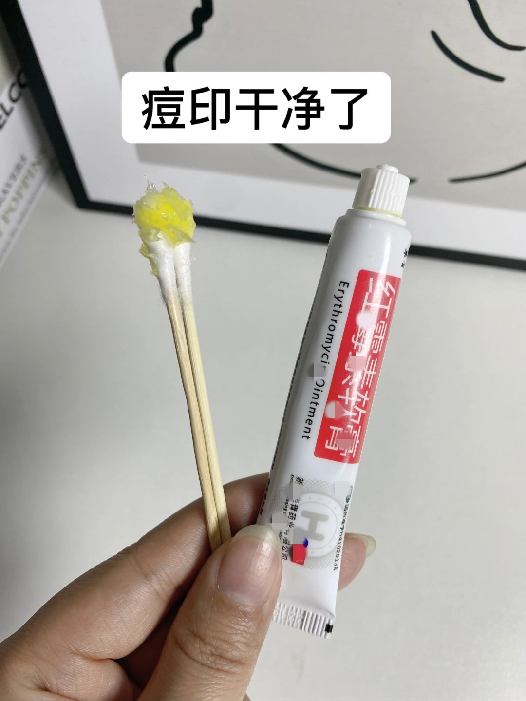绝对不删！痘印姐妹不看就亏了！