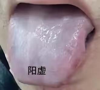 中医说：气虚无力、阳虚怕冷、血虚发白、阴虚发燥（热）！
老百姓的智慧最为质朴而深