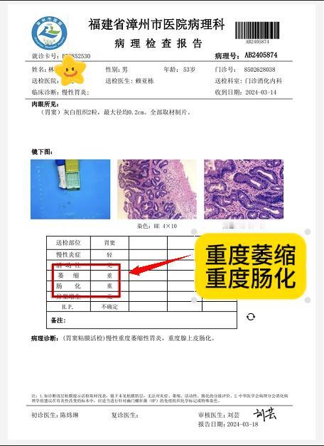 林师傅，53岁，治疗前：重度萎缩性胃炎、重度肠上皮化生。
经过半年的中医治疗，萎