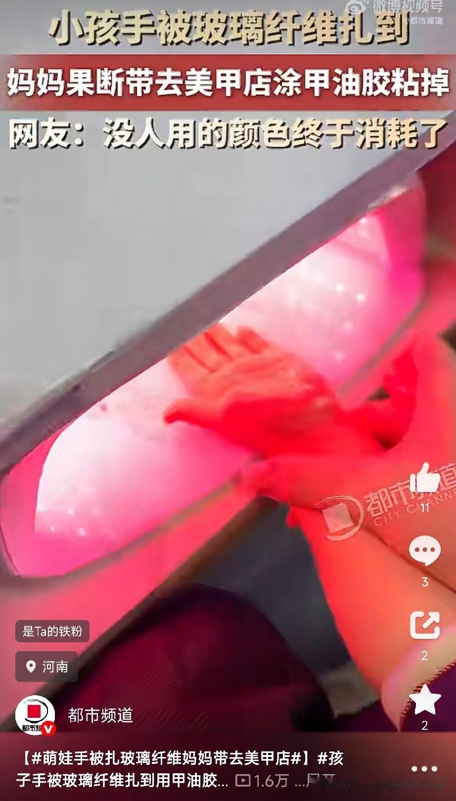 这的确是一个好办法

10月5号，河南一孩子手被玻璃纤维扎到，又细又疼，肉眼几乎