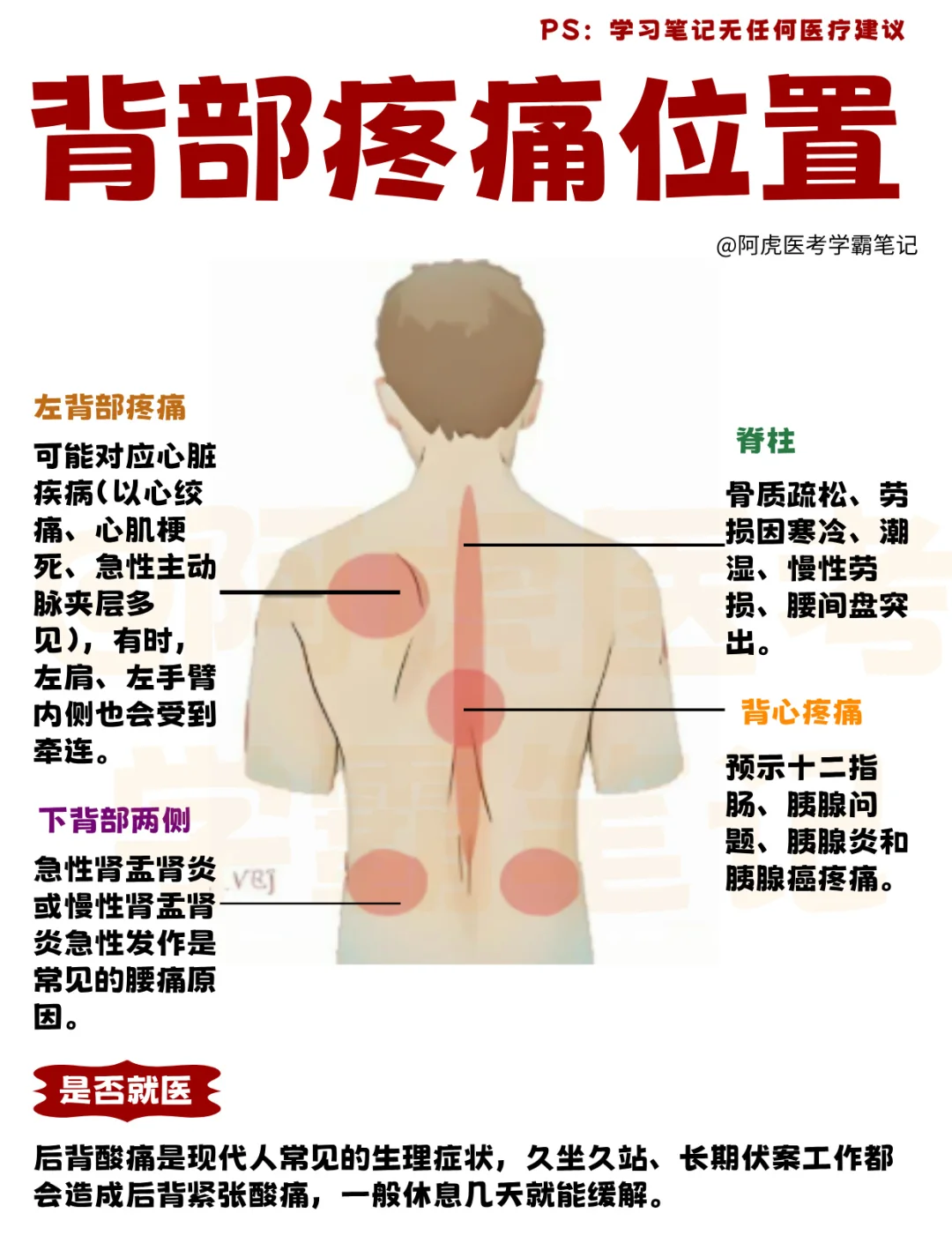 医学生笔记📒｜背部疼痛位置图解👆