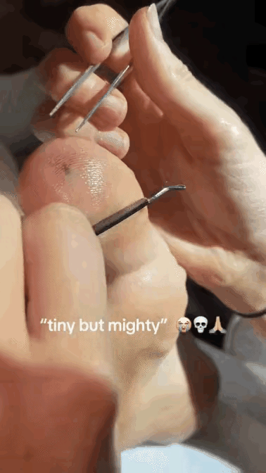 隔着屏幕都觉得疼