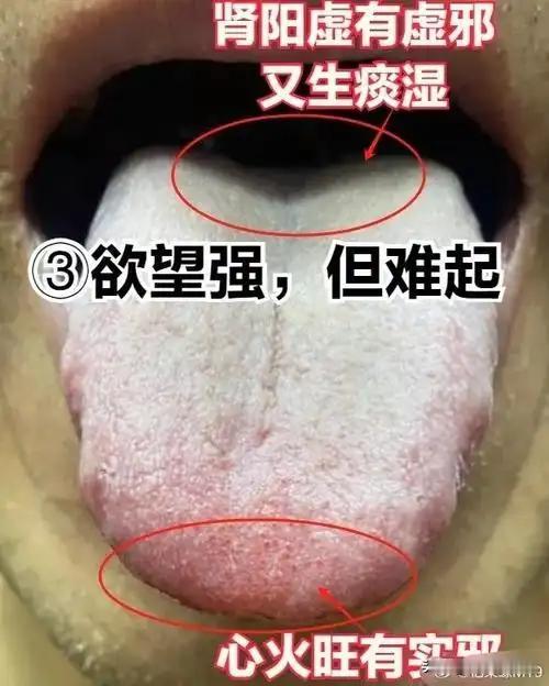 肾精虚、肾阴虚的人，欲望比较大，这是虚火扰乱你的心神，你控制不了。
欲望过分亢奋