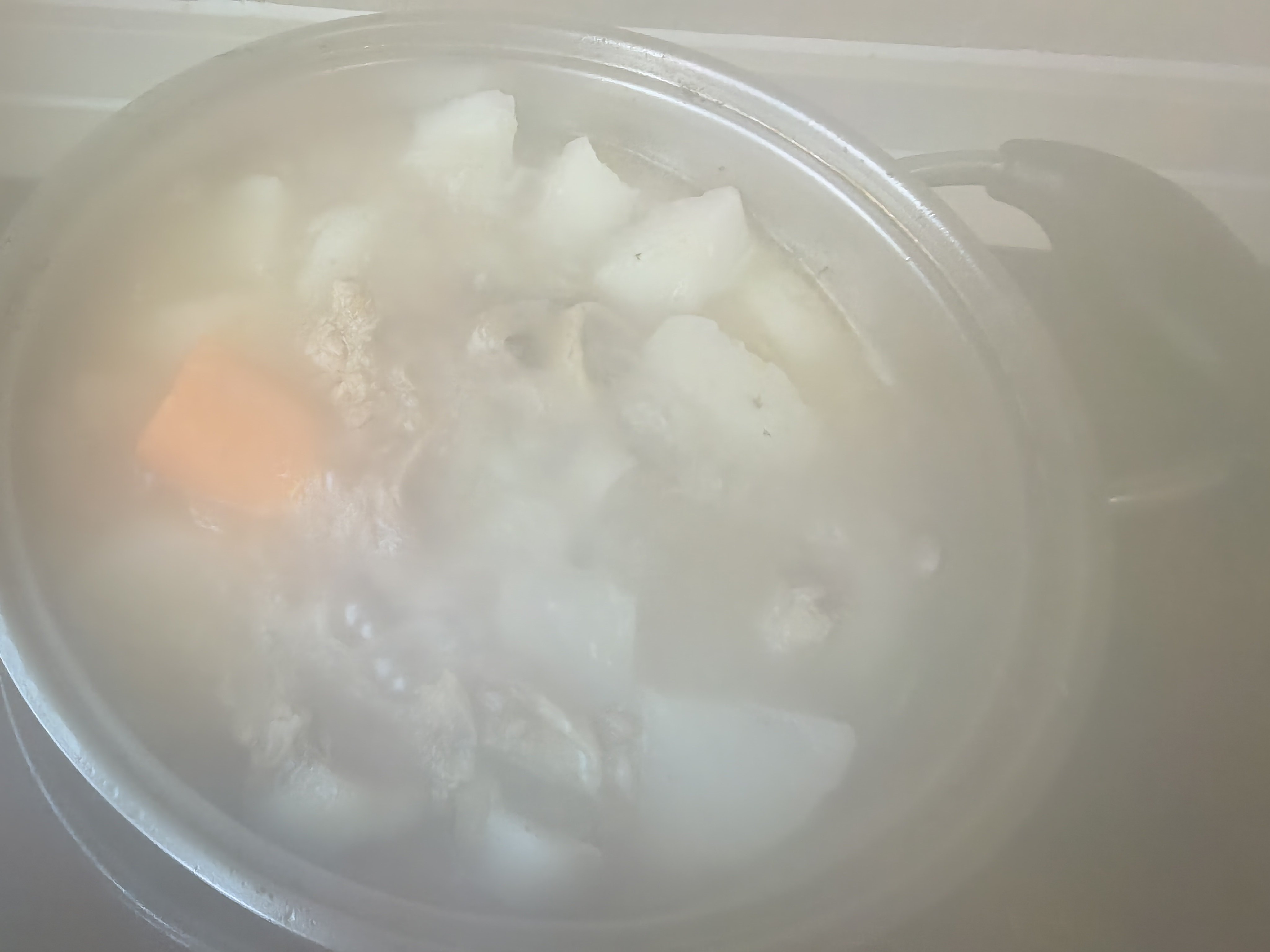 真的是祸不单行呐，本来术后在家，说自己煲点汤吧，结果还把手给烫了。这接下来给自己