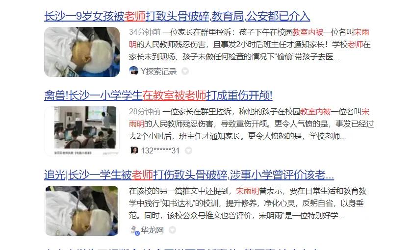 这老师太残忍了，把学生打到医院。