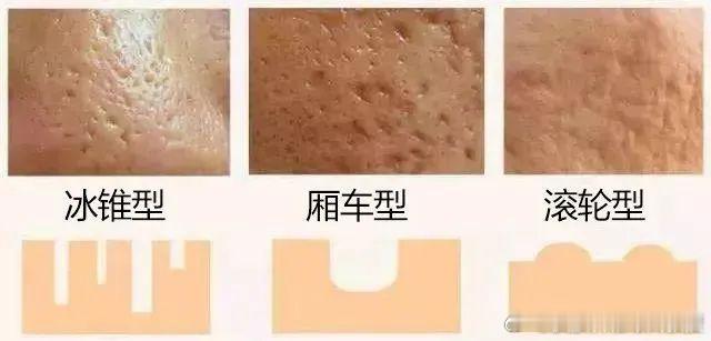 #做医美能把皮肤变好吗# 答案是可以的。护肤的本质是维稳，是让皮肤状态饱满，而对