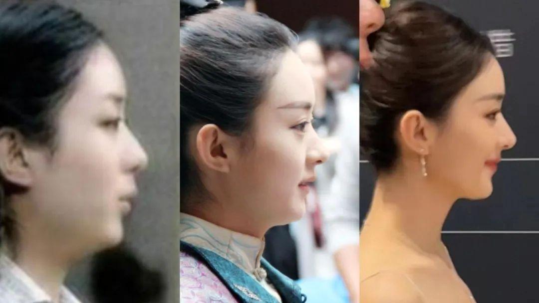 红气养人之赵丽颖。