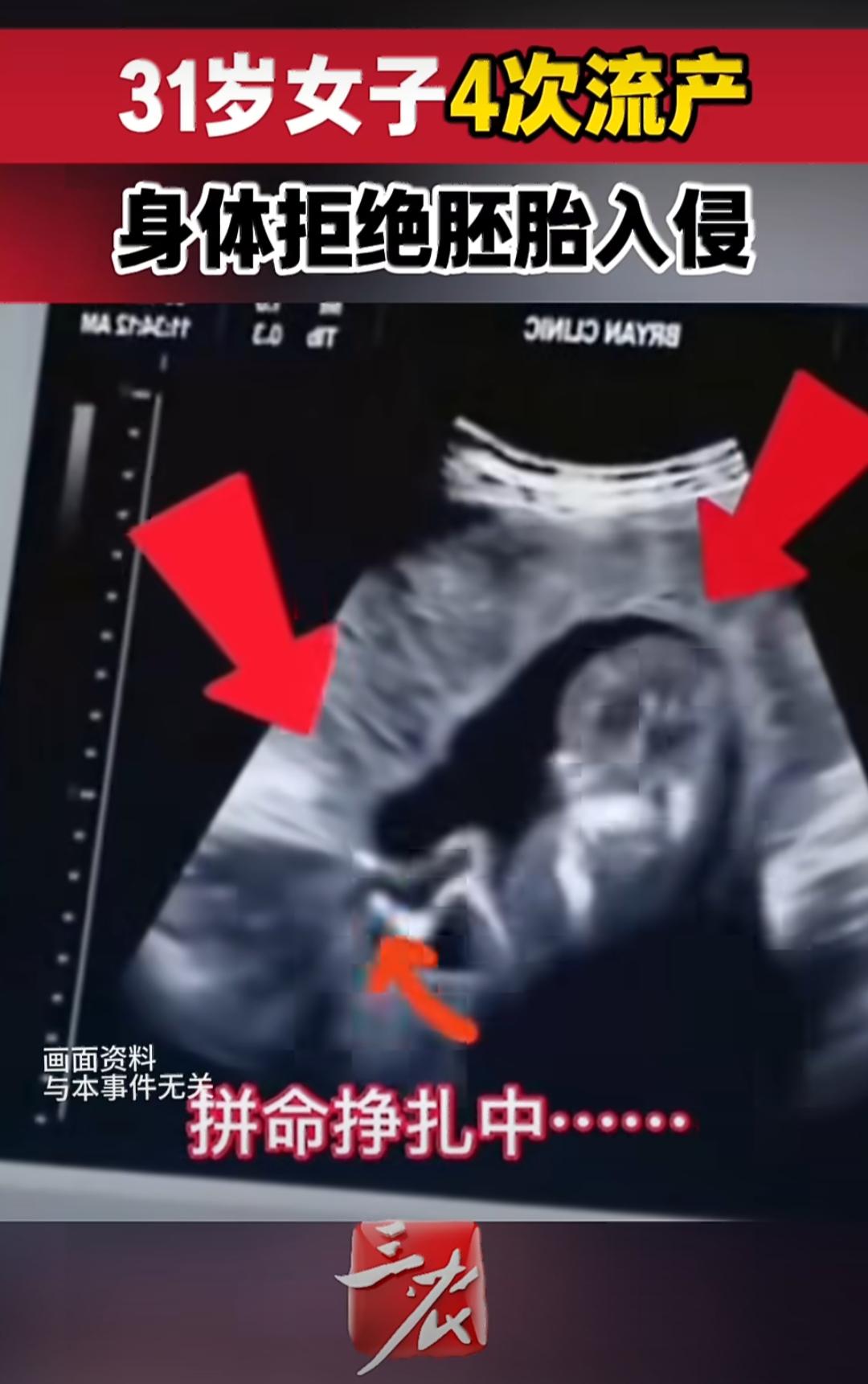 31岁的福建女士汪女士，盼了整整八年，终于圆了自己的母亲梦，抱着健康的宝宝那一刻