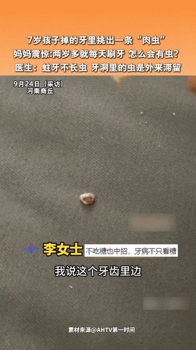 这下真解释不清了！河南一位妈妈，在孩子脱落的乳牙里，挑出一条肉肉的“虫子”，当场