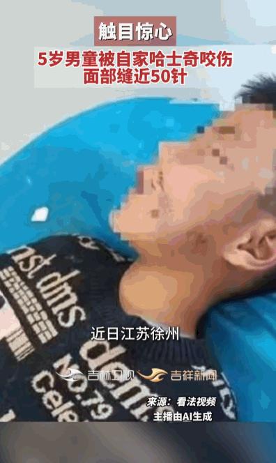 谁能想到，平日里黏人乖巧、养了好几年的哈士奇，会突然对朝夕相处的 5 岁小主人痛
