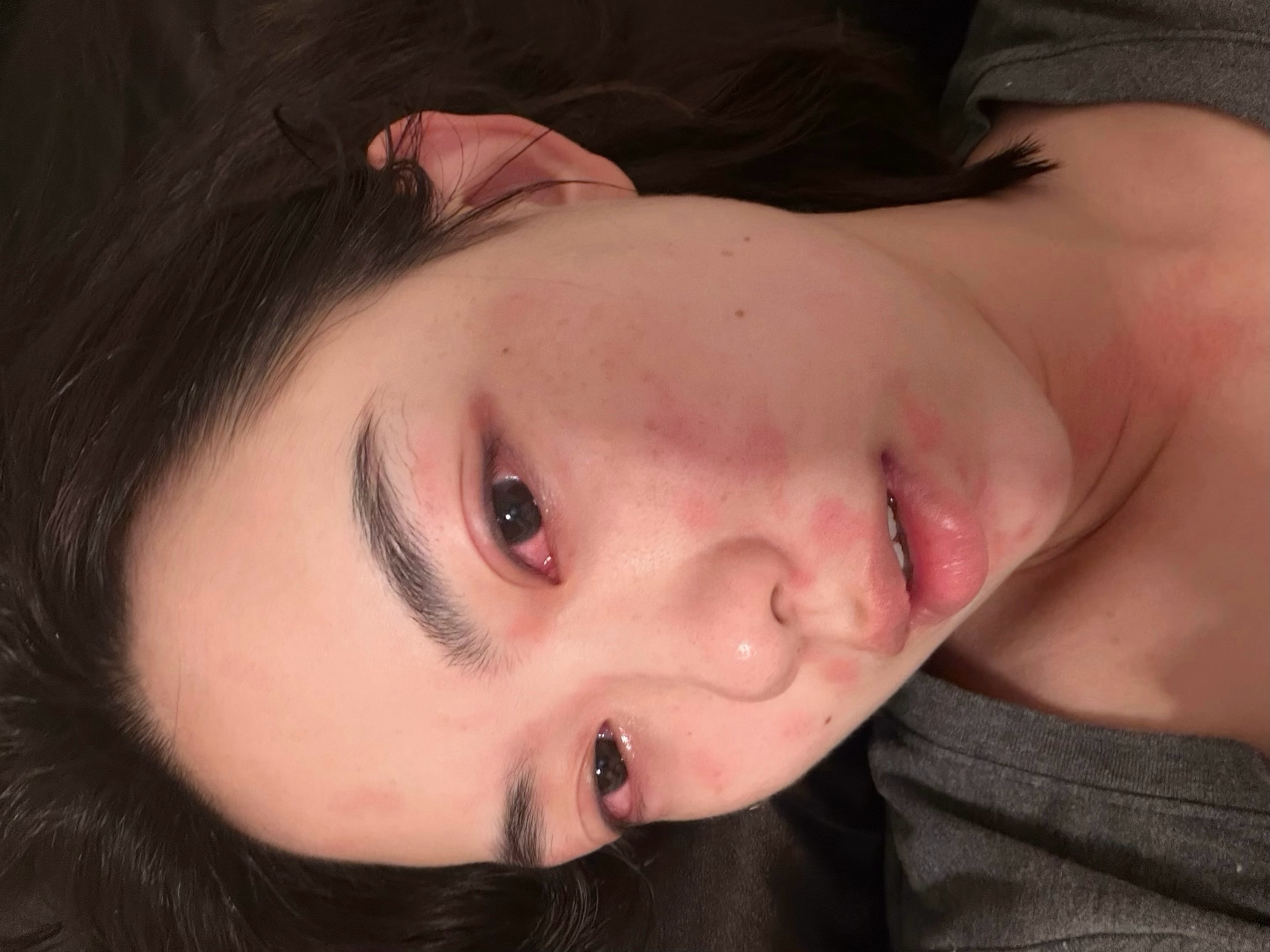 俺不中了 看到这个热搜想到我昨天摸猫过敏每次碰到可爱的小猫只能远远看着小猫还原自