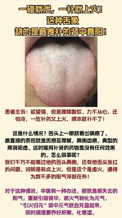 今日舌象分析