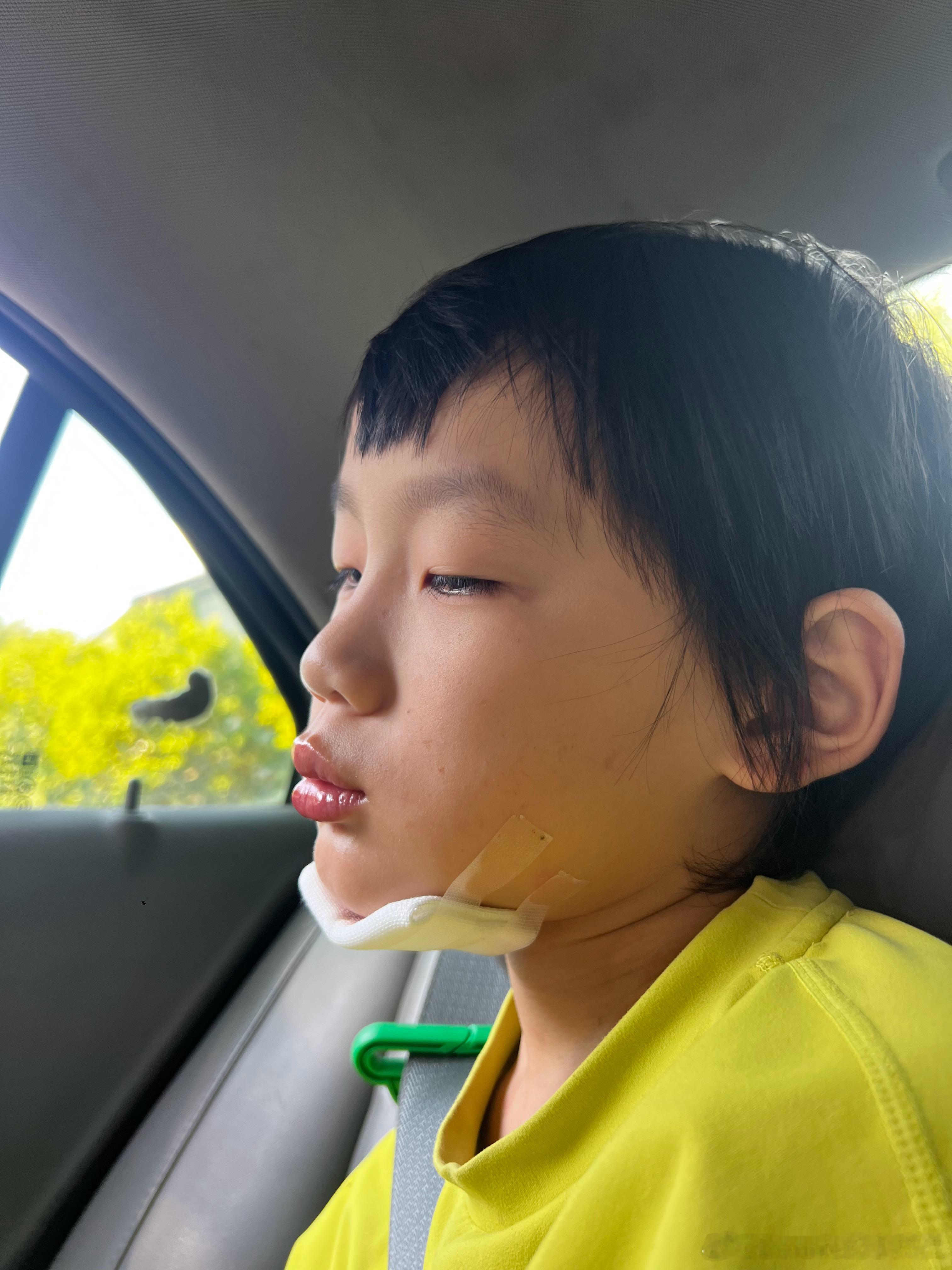 如果孩子受伤了，你们敢清楚的去看伤口吗？小皮两次豁这种要缝针的大口子，都是我老公