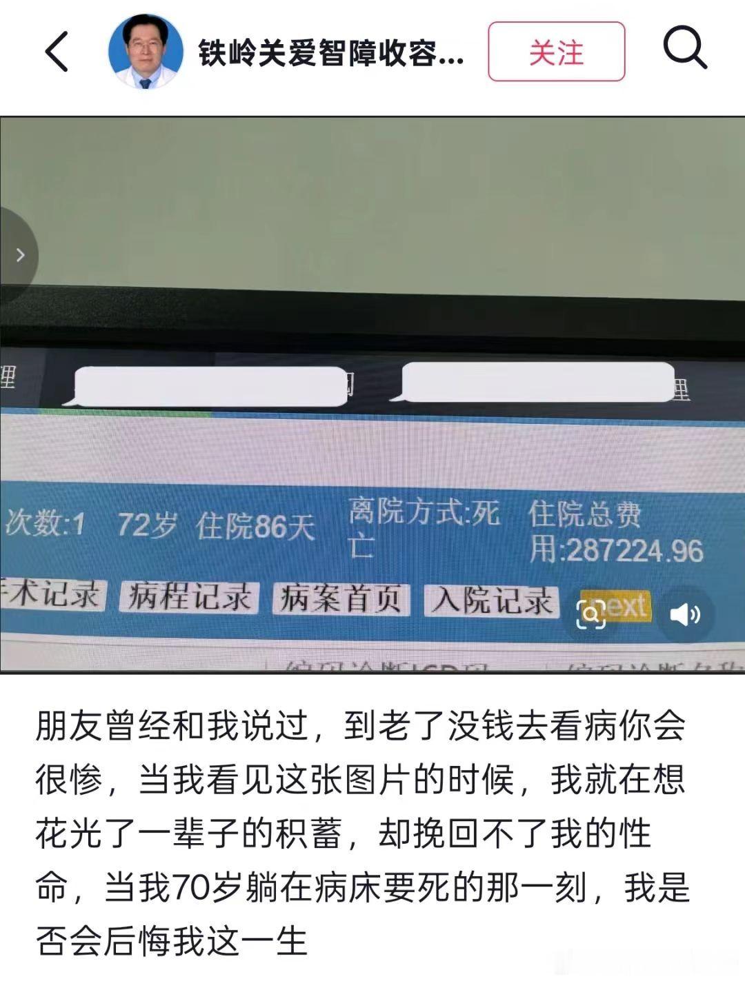 28w，续命86天，值吗 