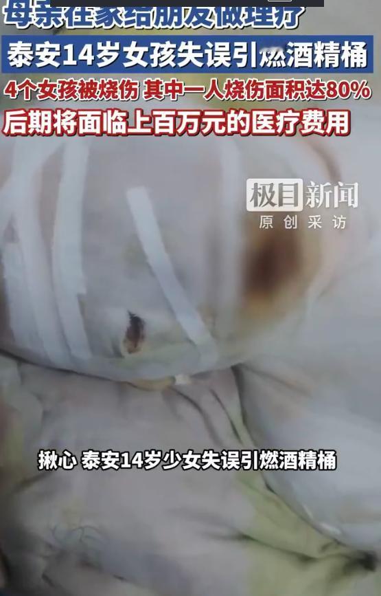 太痛心了！山东泰安一女子在家拔罐，14岁女儿误将酒精倒进带余火的艾罐引发爆燃，致