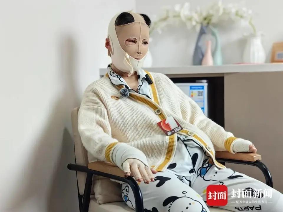 【男子烧伤前女友出庭还在笑 当地提级审理】2月5日，“男子泼汽油烧伤前女友”一案