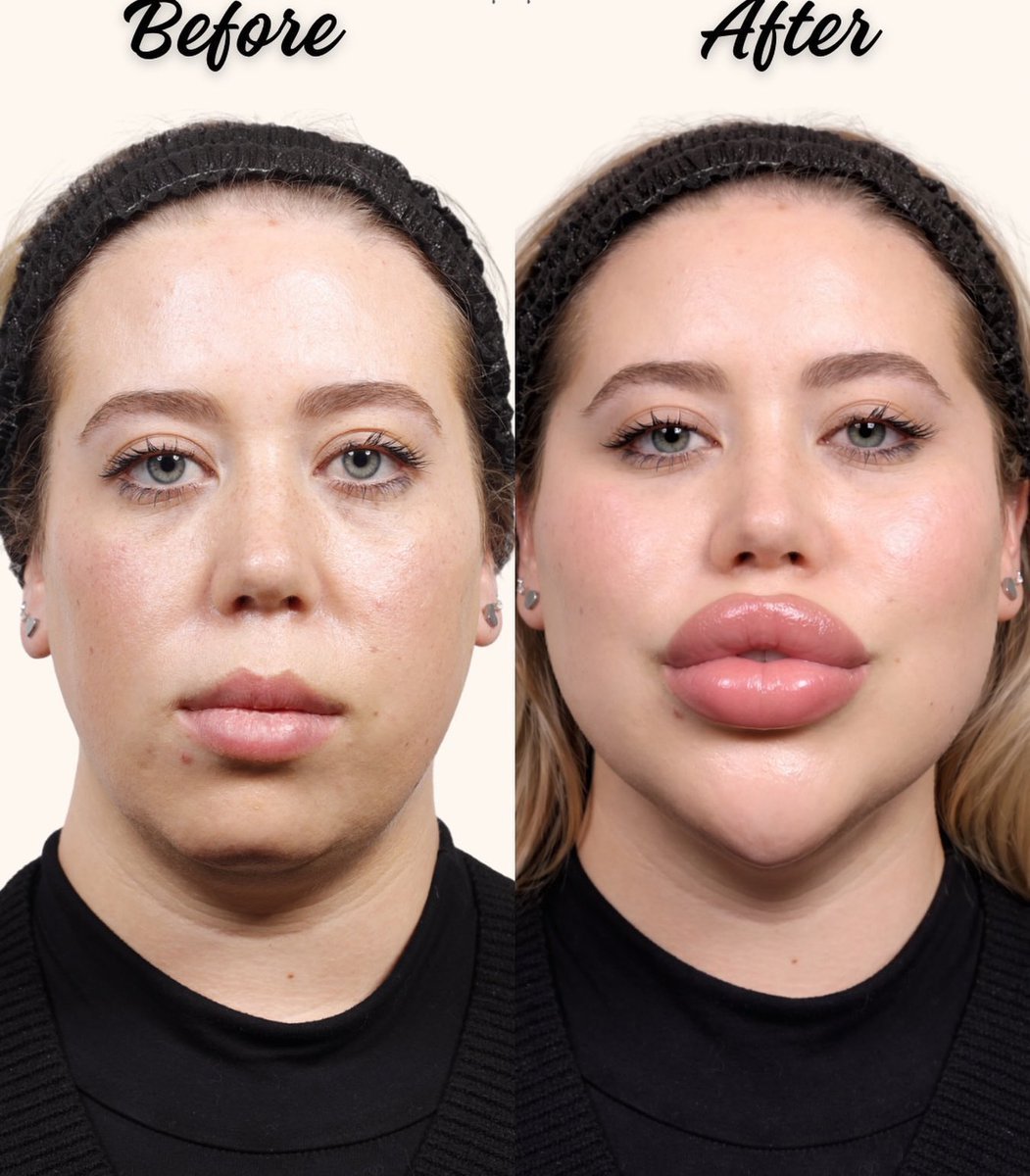 不理解老美审美，尤其是厚嘴唇这种 