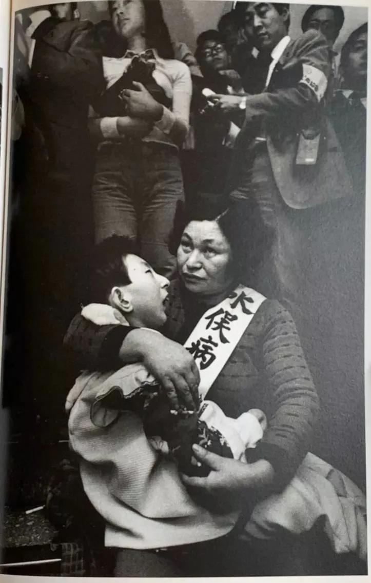 1957年，日本，一名患有“水俣病”的孩子，被母亲紧紧抱着，参加着抗议活动。然而