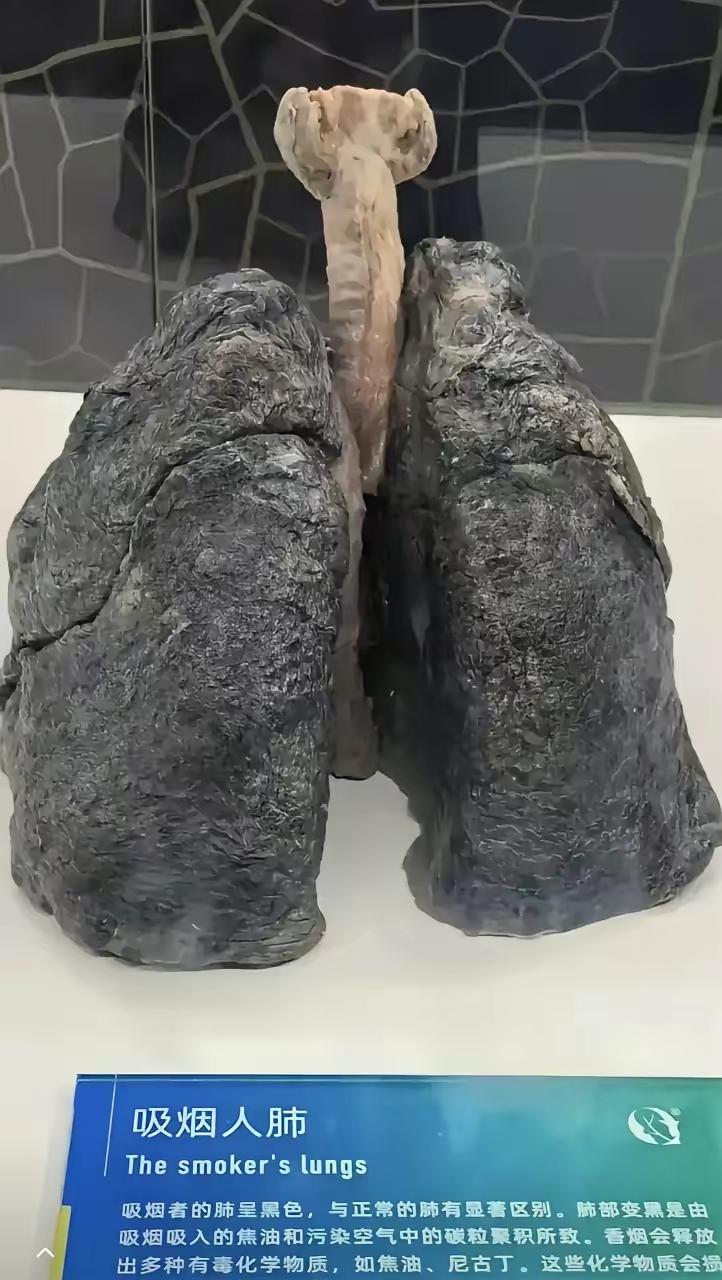 看那黑如焦炭的双肺，没有个一天三包烟的量是达不到这种境界吧！还发现个有趣的现象，