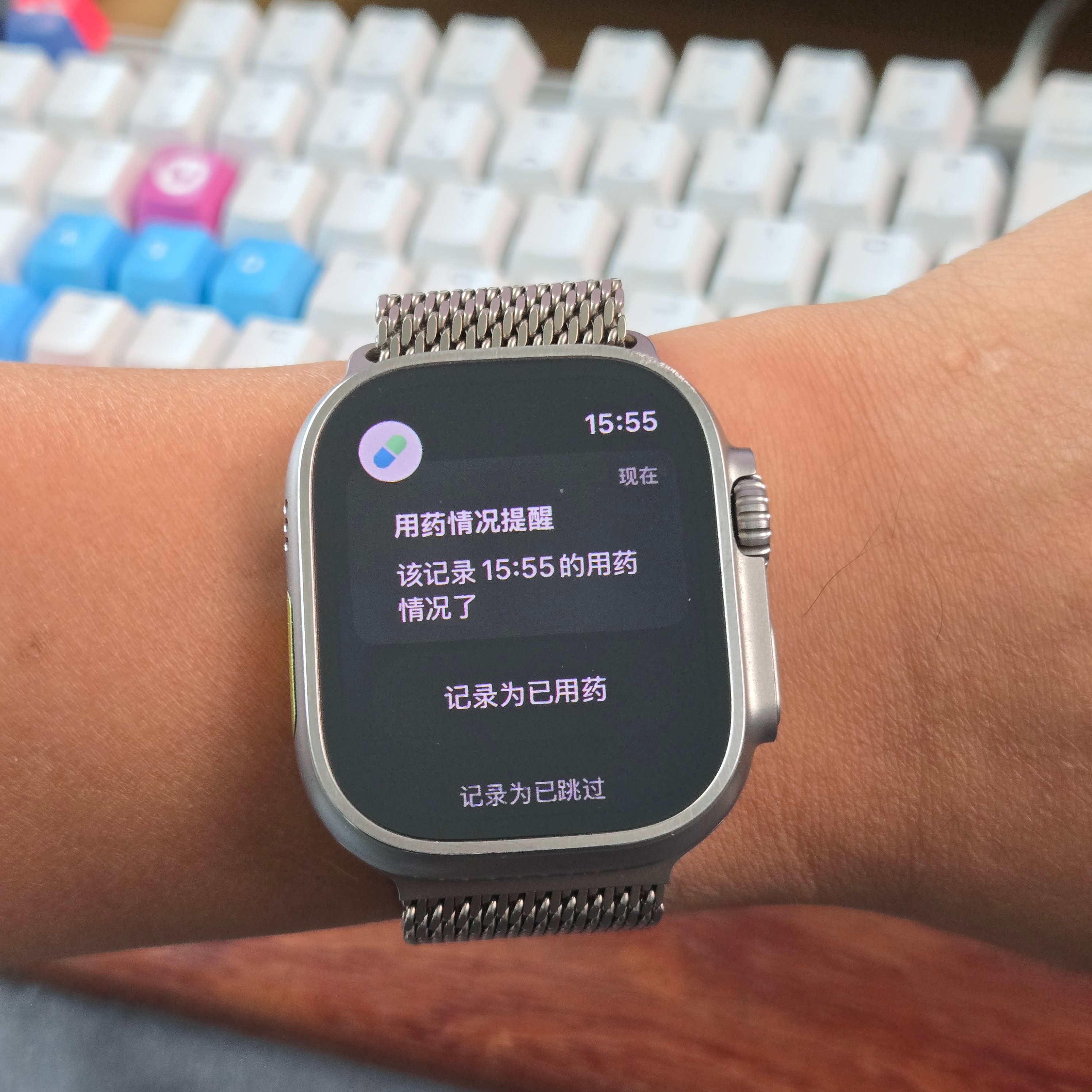 Apple Watch只有一个缺点，剩下的都是优点。老黄，该吃药了。 ​​​