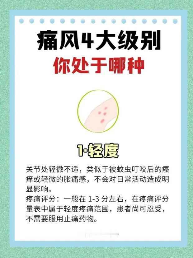 健康科普：痛风的四个发展阶段与轻重分级