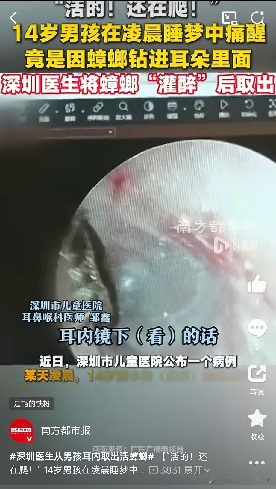 14岁儿童被痛醒，活蟑螂在耳朵里爬！

近日，深圳市儿童医院公布了一个病例。14