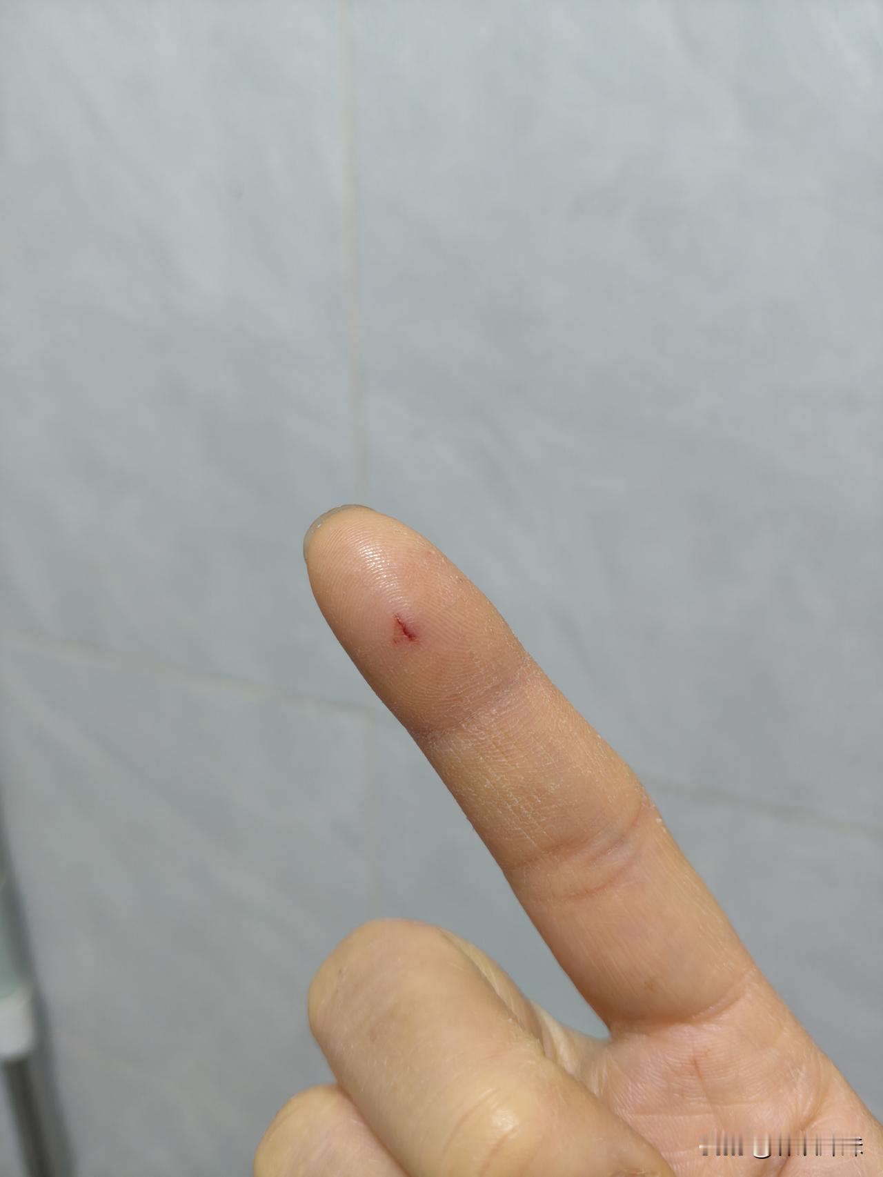 被小仓鼠咬了需要去打狂犬病疫苗吗？

姐妹们，我被小仓鼠咬了，不是以前那只可爱乖