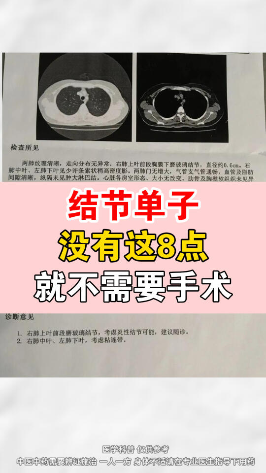 结节单子没有这8点就不需要手术