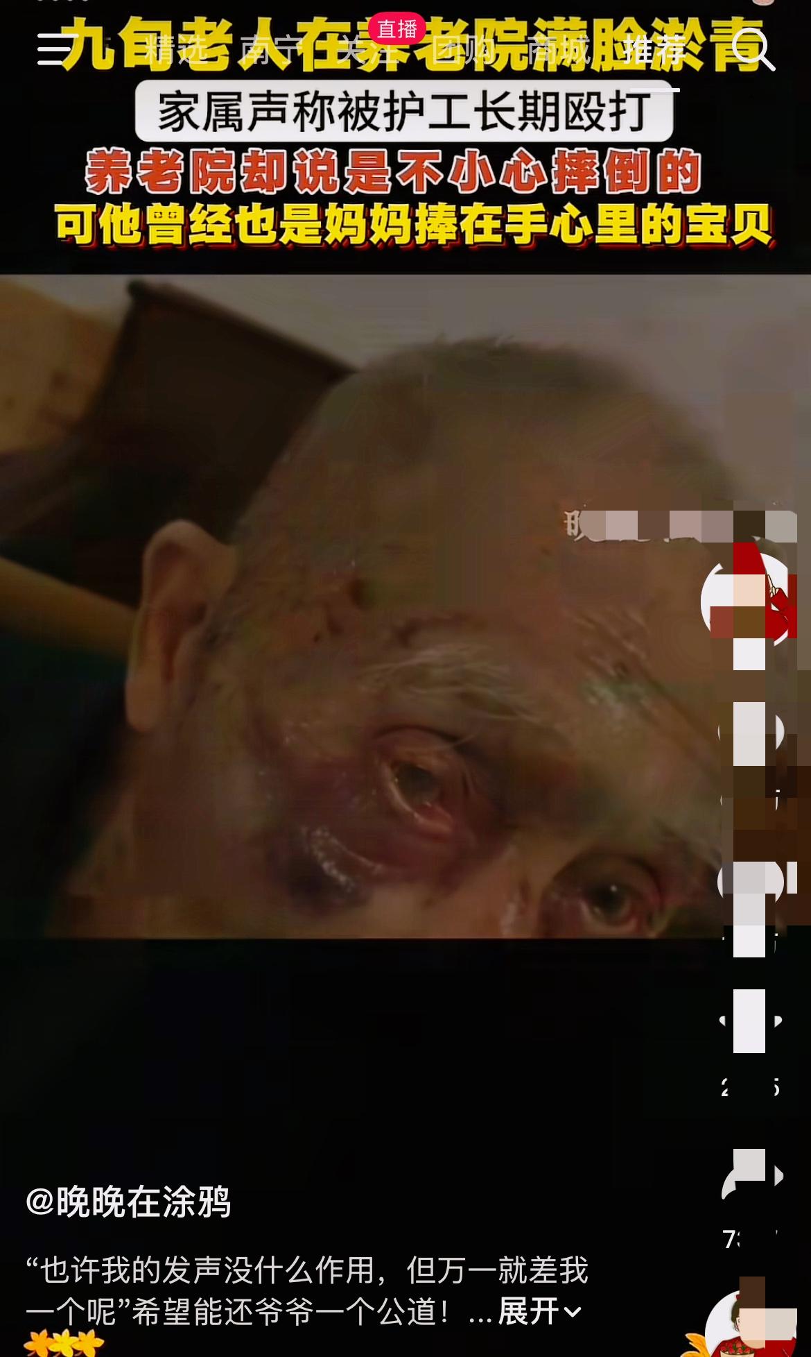 我们送的是晚年，不是“无人区”！

刚刷到这事儿真难受了！九旬老人在养老院满脸淤