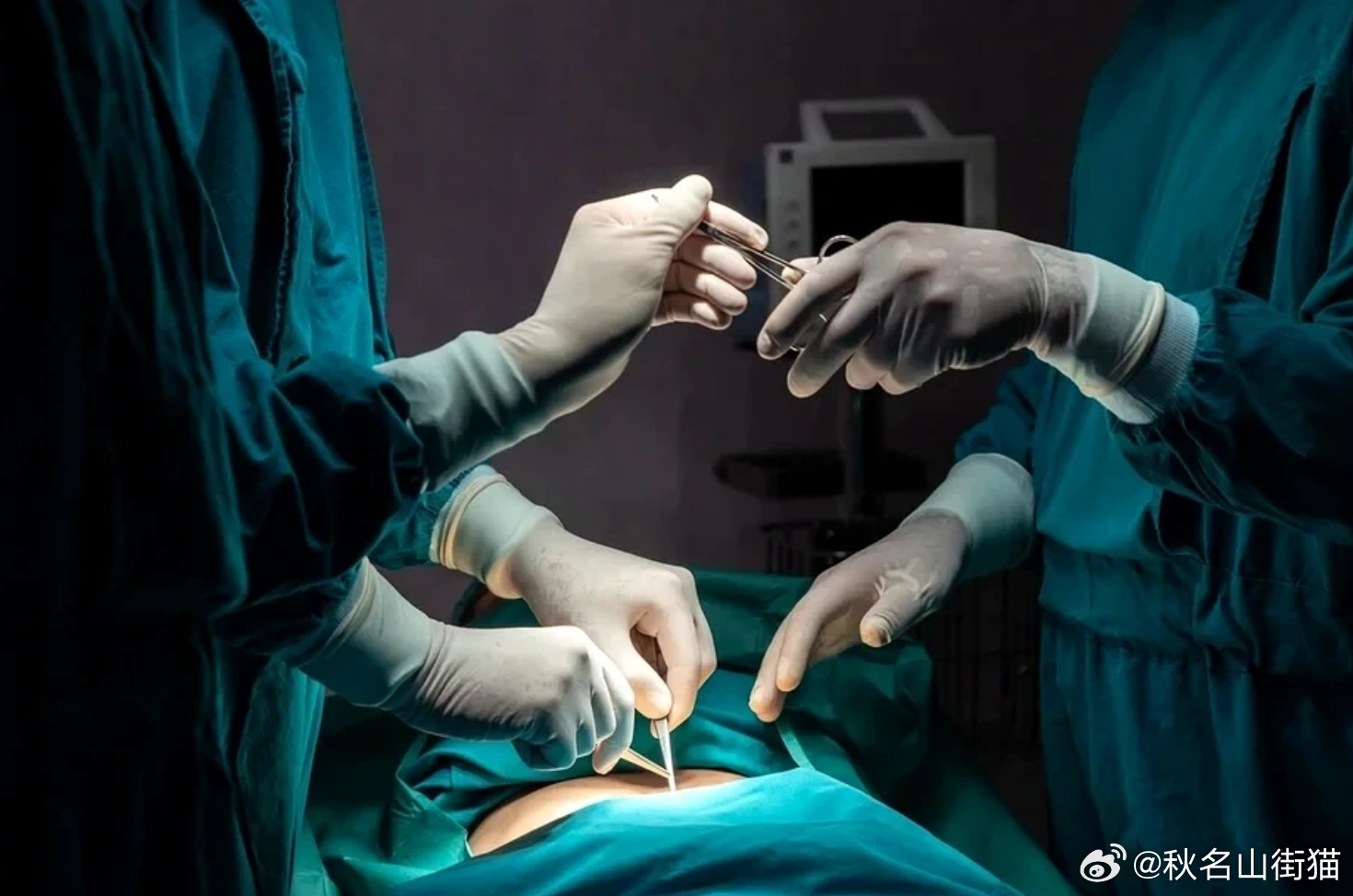 白挨刀！女子被告知只剩5年寿命 子宫切除后惊曝：竟拿错病理报告海外新鲜事 美国佐