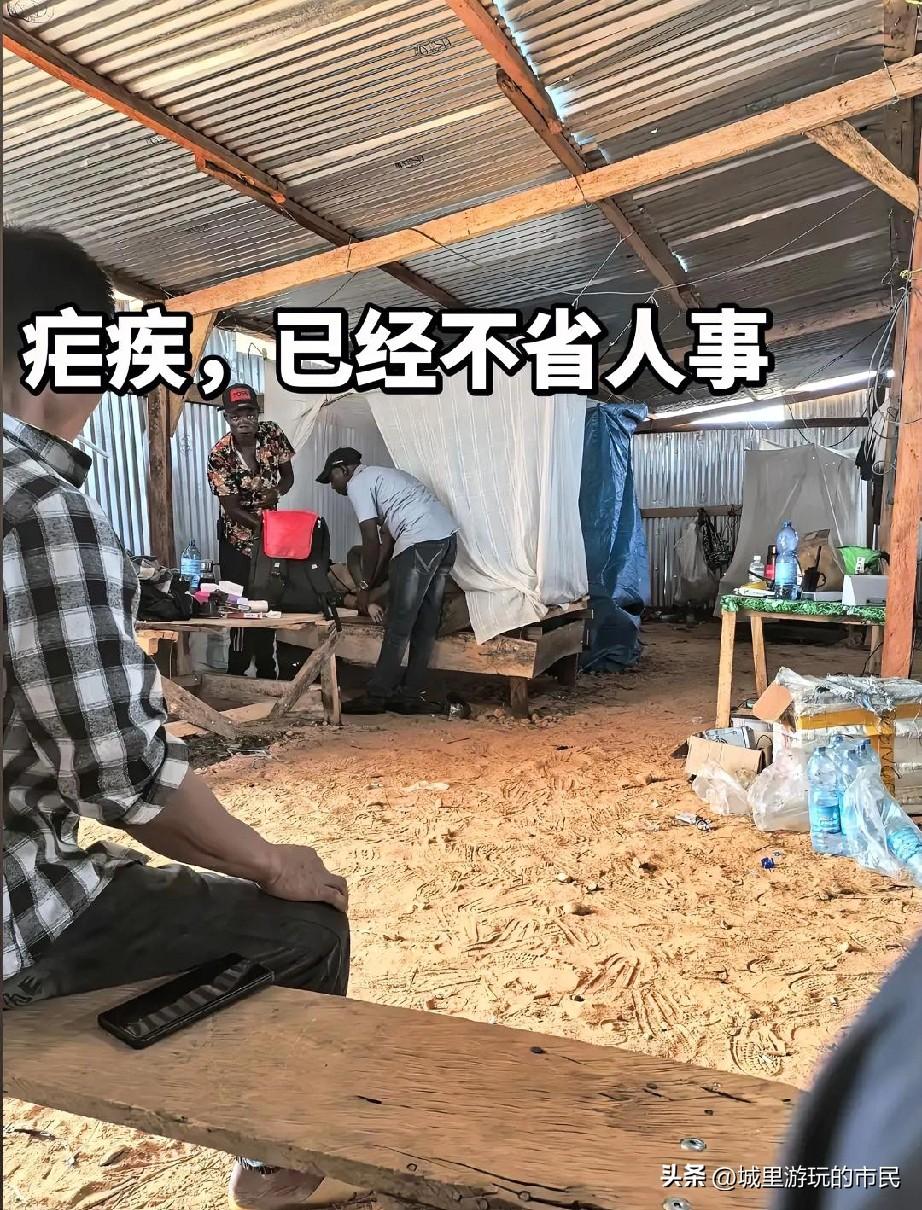 疟疾太可怕，在尼日利亚得疟疾，过了15天在巴西发作，高烧直接昏迷，送去抢救了一个