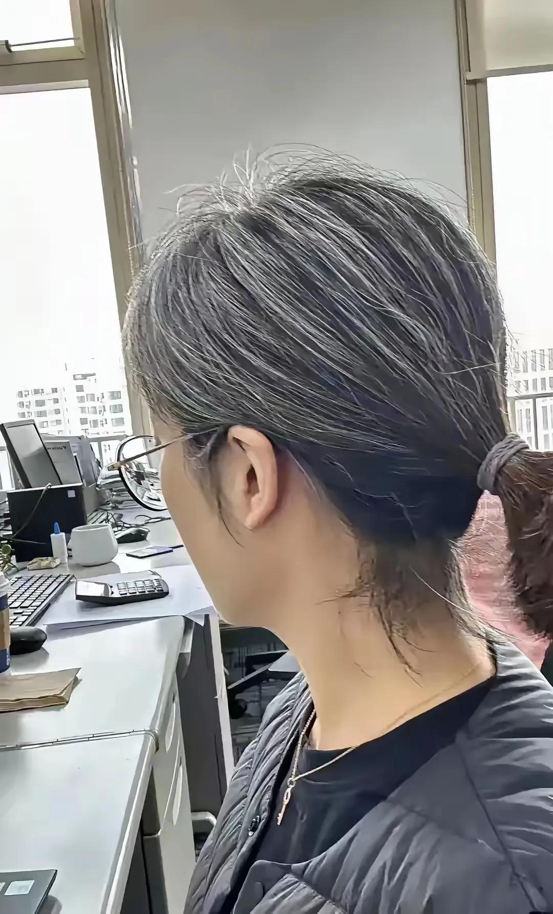年轻人长白发为啥越来越多了？
一个亲戚女儿年纪轻轻就满头白发，要愁死亲戚了，用了