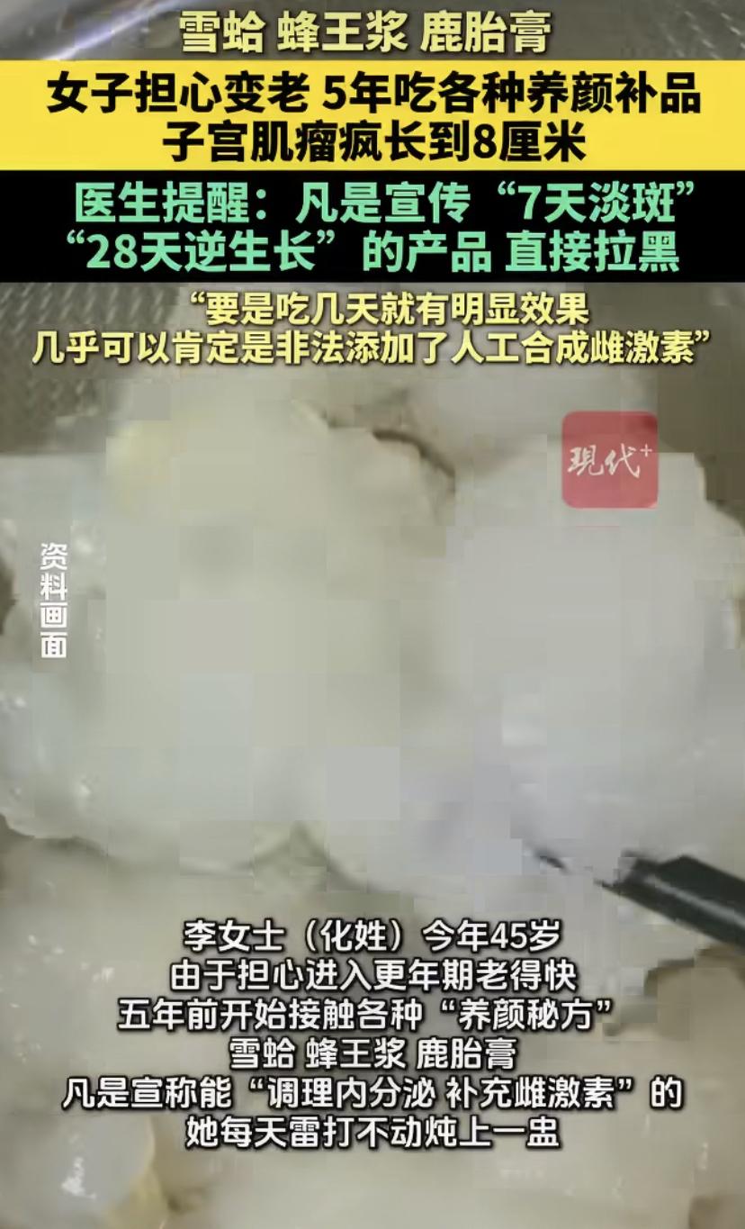 45岁大姐为"冻龄"狂吃补品，本想养颜却把子宫“喂”出个大瘤子!
都说"岁月是把