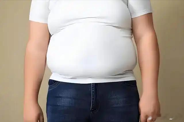 脂肪肝 大肚子，一个妙方“化湿消脂方”解决它。 汉古经方 患者，体重158斤，肚