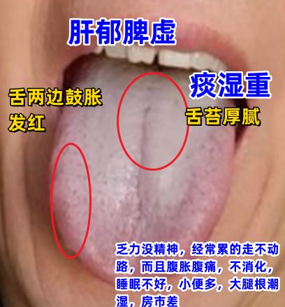 今日粉丝舌诊，案例分析，对照看看，你能从自己舌头上看出什么问题吗？[给力][给力