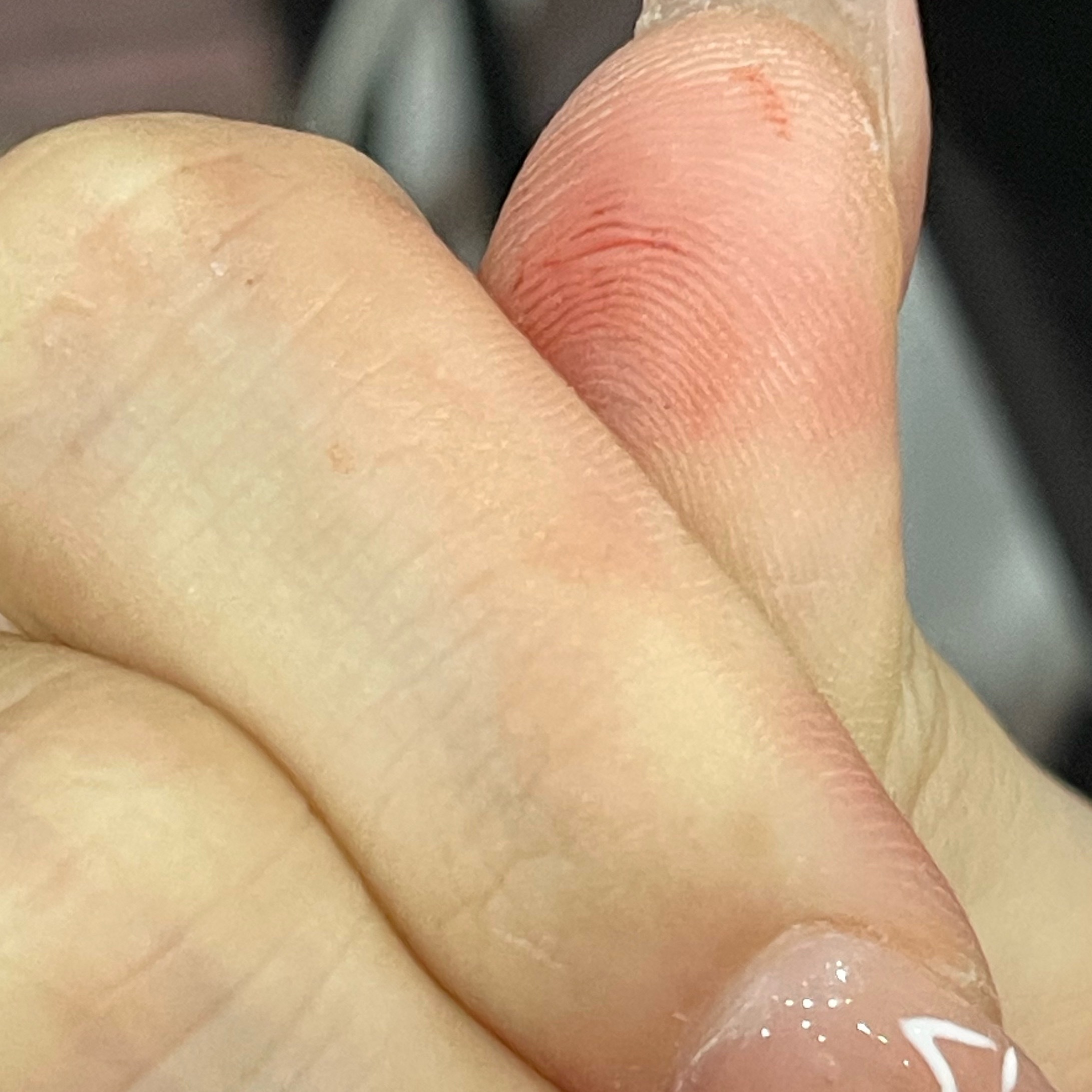 额滴娘 大家装灯牌还是小心一点吧。。🩸擦到灯牌上了我才发现。 