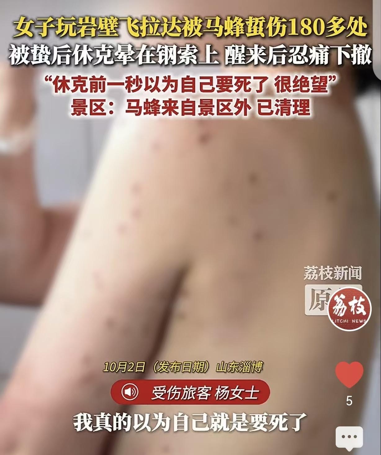 山东淄博，一女子一行4人，去营地玩“岩壁飞拉达”。她们在2座山间的钢索上，被马蜂
