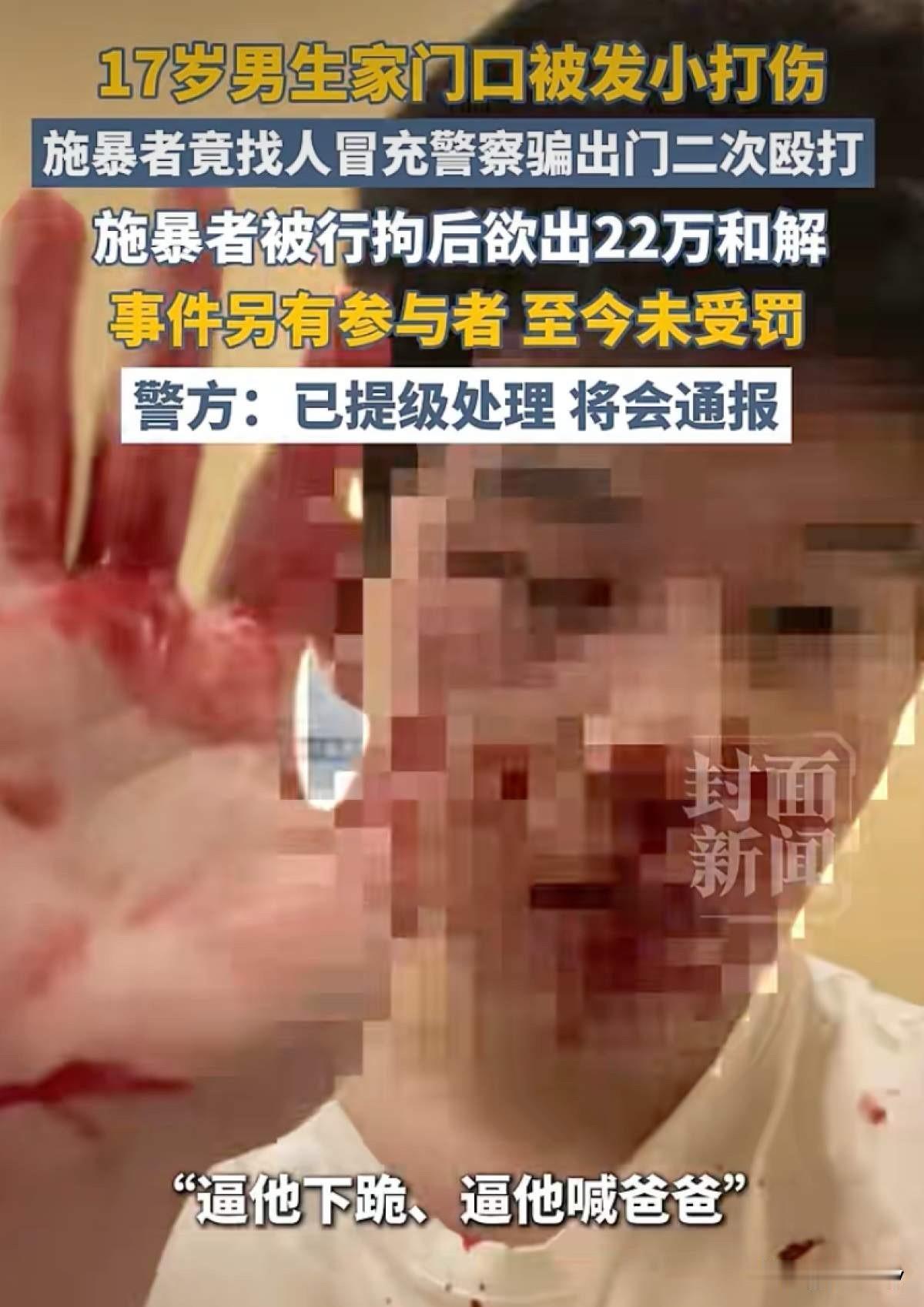 无法无天！山西运城17岁男生小雷被校友王某打伤后报警，谁知对方竟然找人冒充警察把