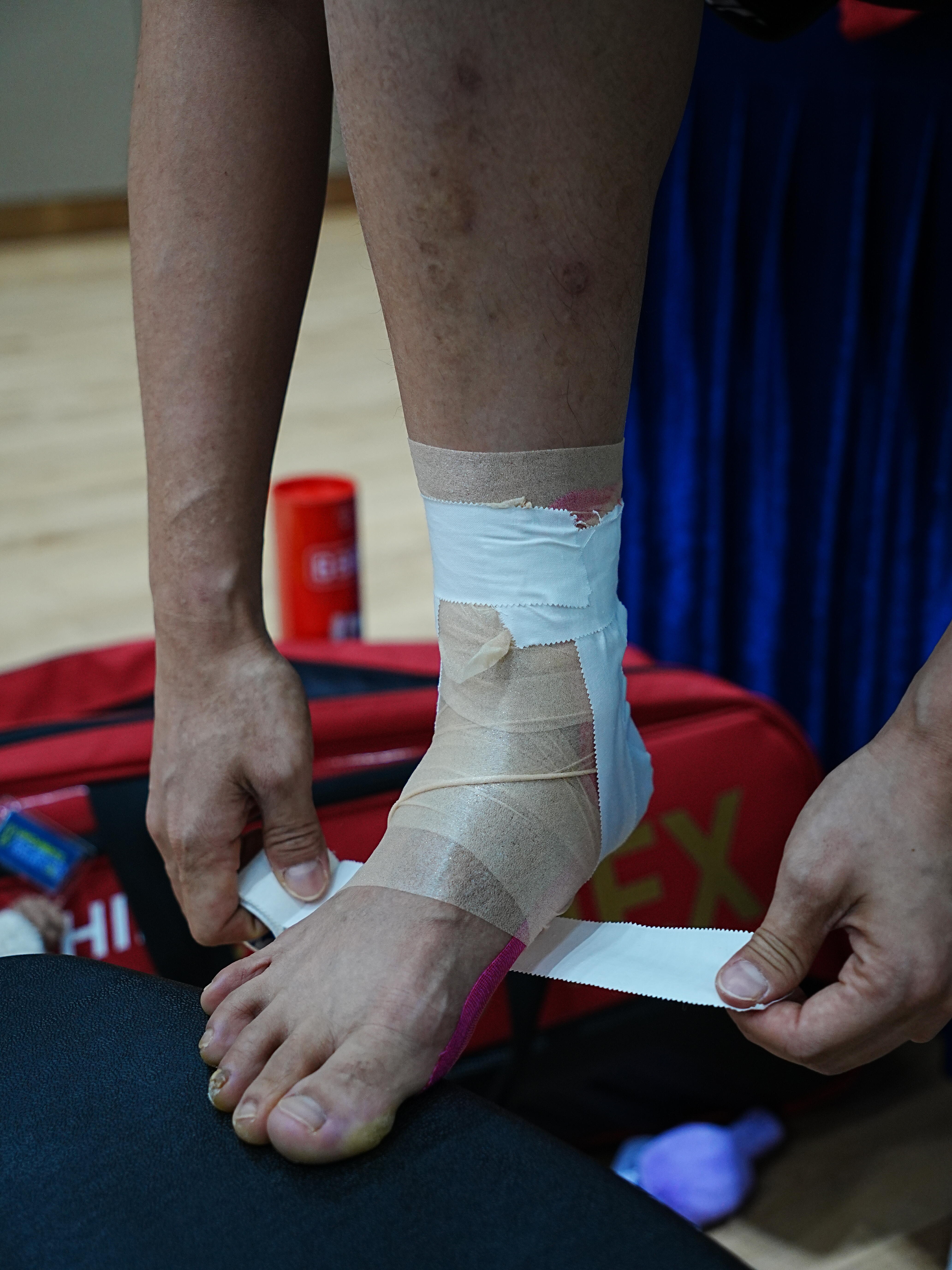 这个女孩从来不说，看得都要疼死了😭😭😭 黄东萍你把自己当铁人了吗