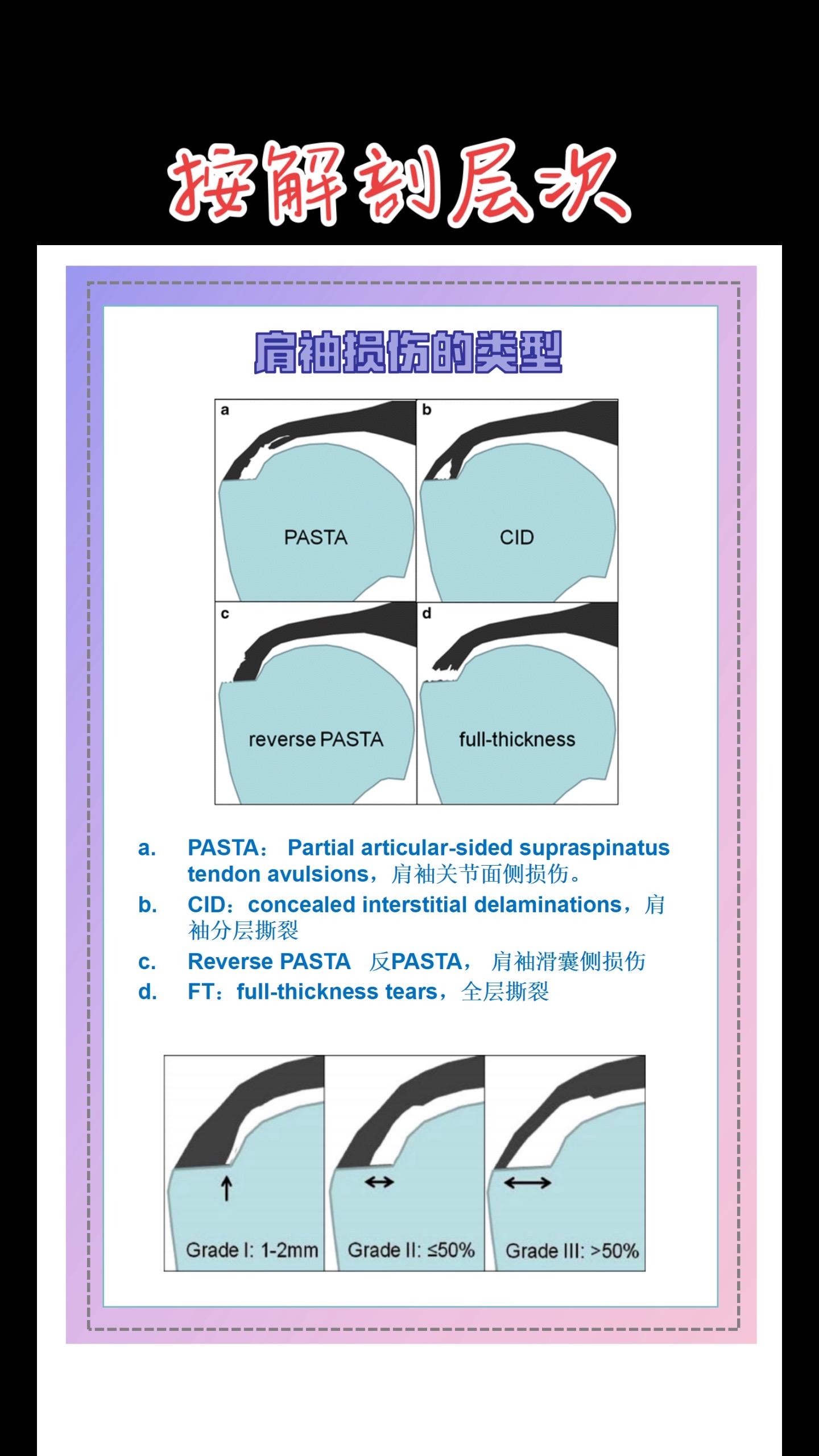 肩袖损伤类型（按解剖层次）