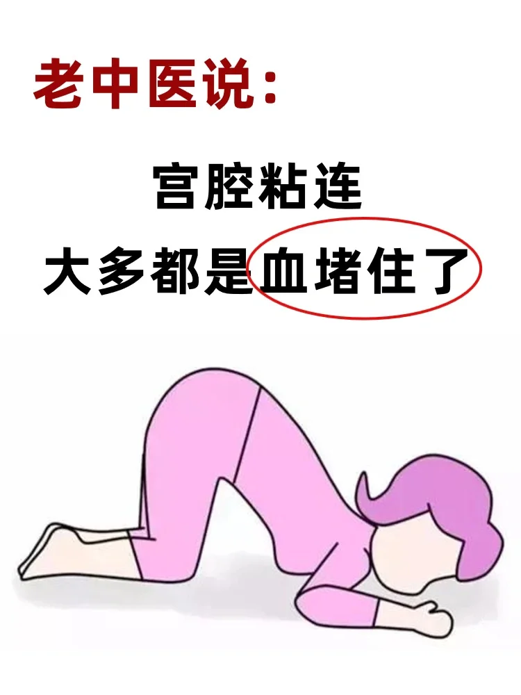 老中医说：宫腔粘连大多都是血堵住了！